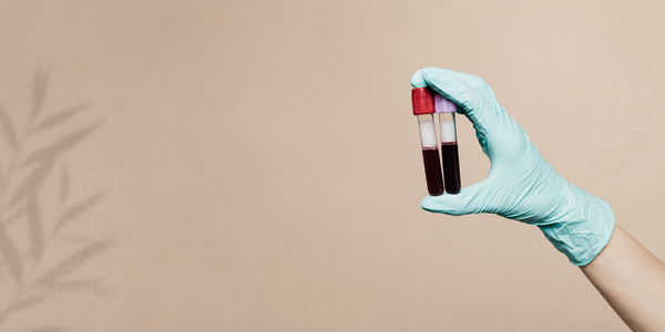 Blood Test for Vitamin Deficiency