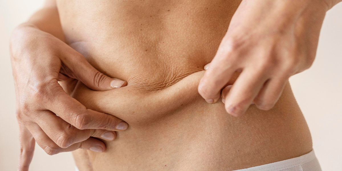 glutathione stretch marks How Collagen Helps With Scarring and Stretch Marks