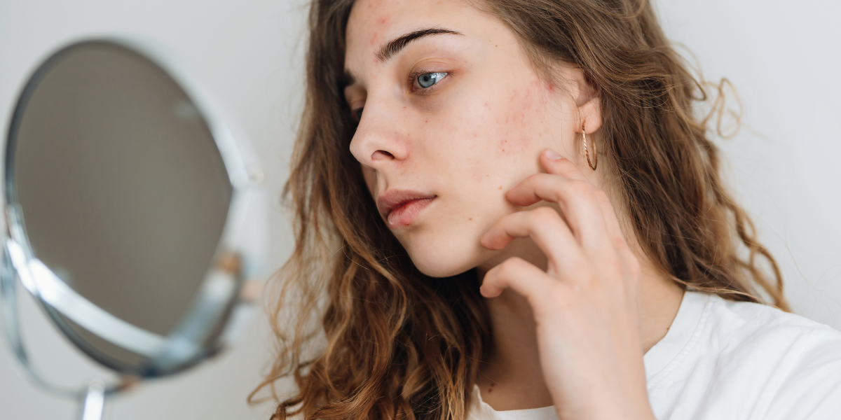 5 Things You Can Do to Reduce Signs of Pigmentation