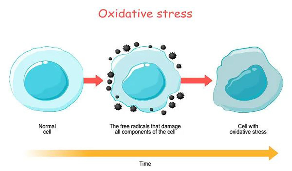 Oxidative Stress Causes Remedies