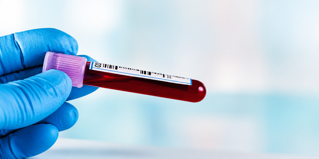 How Often You Should Have Your Blood Work?