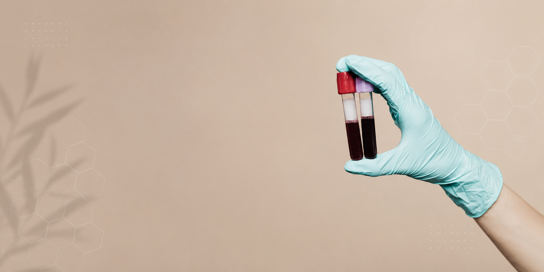Blood Test for Vitamin Deficiency