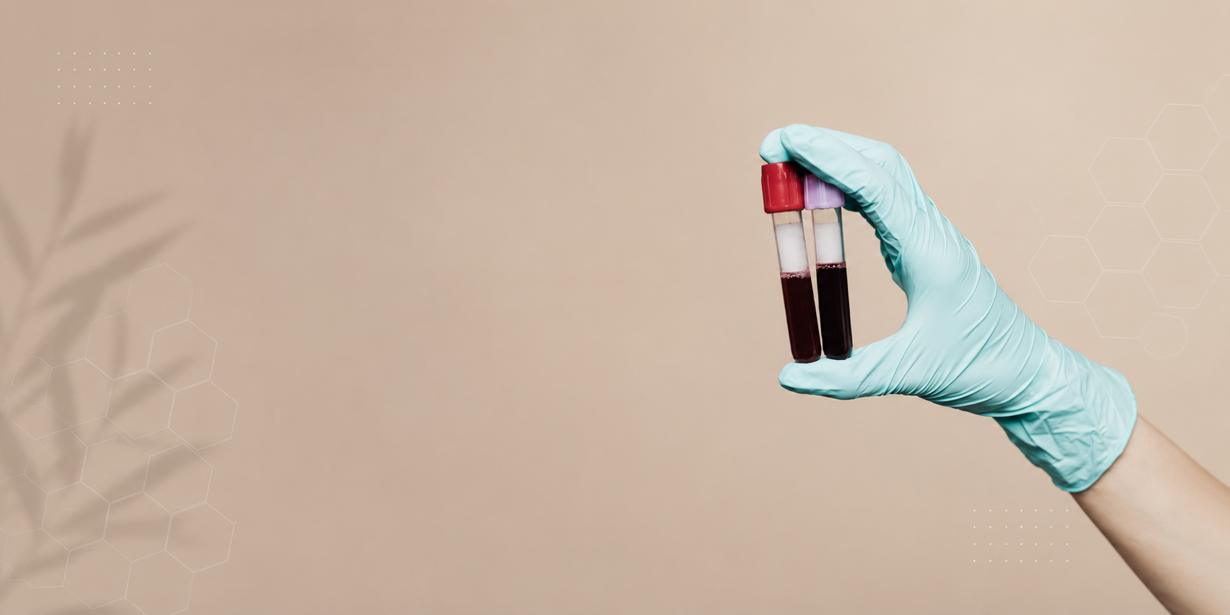 Blood Test for Vitamin Deficiency