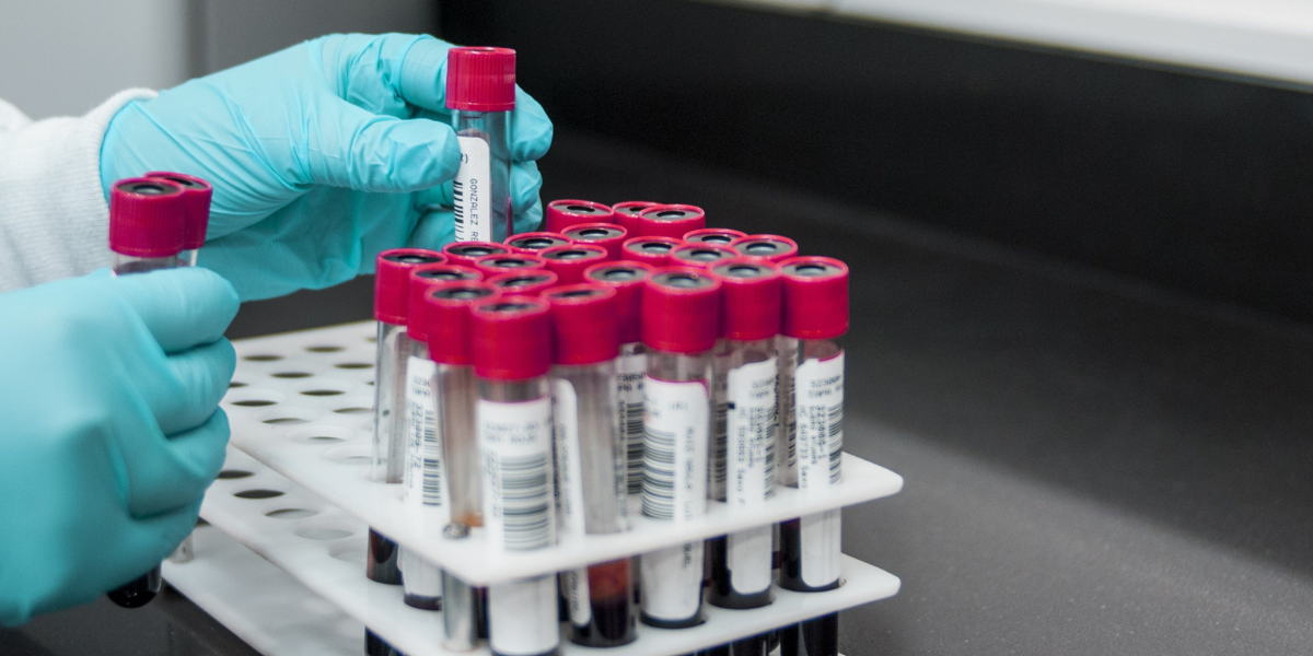 Cholesterol Tests: What They Are and How to Interpret Them