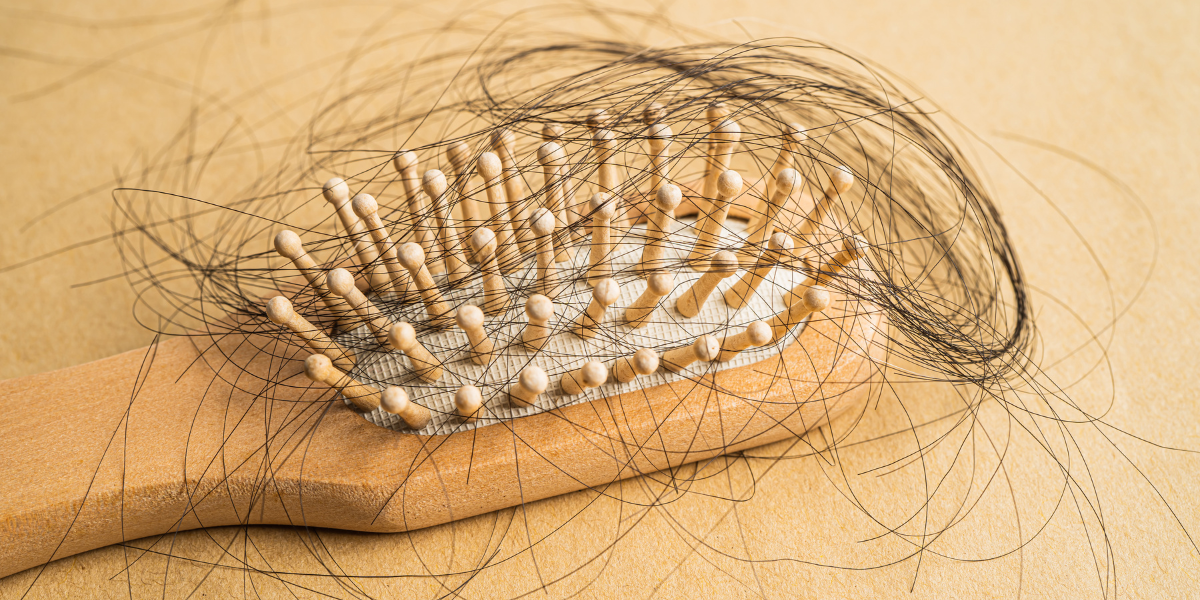 Does Creatine Cause Hair Loss?