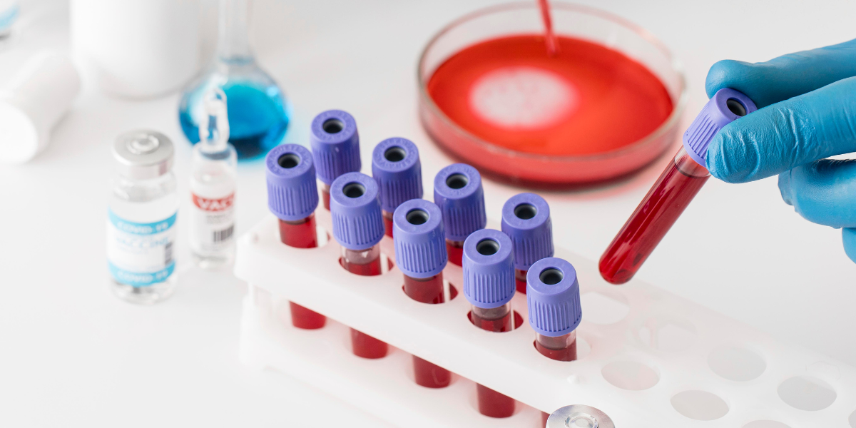 How to Lower Your HbA1C Levels