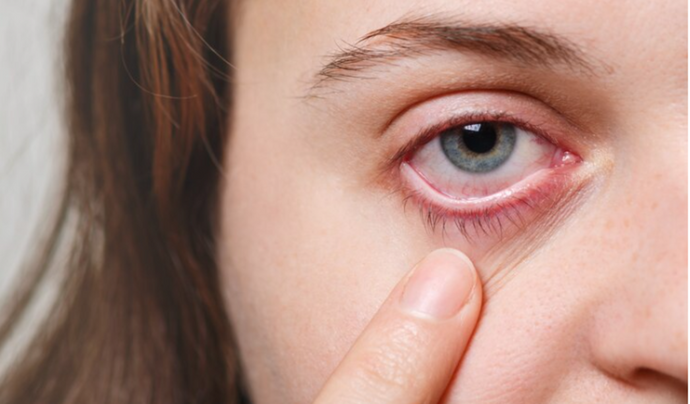 These Habits Might be Causing Dry Eyes