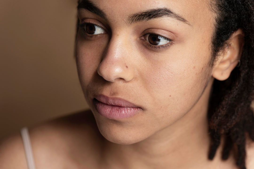 Signs of High Cholesterol on Your Face