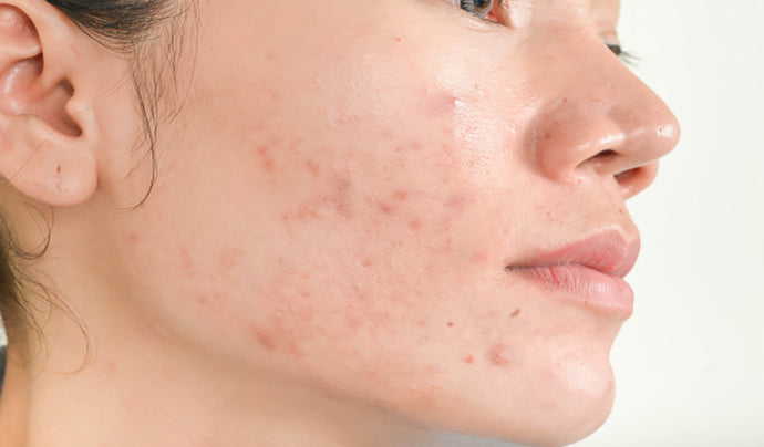 Do you have Unhealthy Skin? Find Out Now!