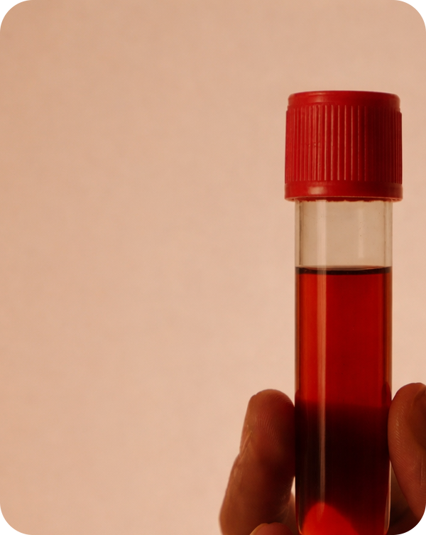 Analyze your biomarkers