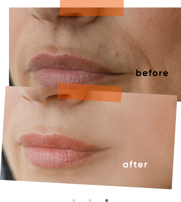 Collagen Results 3