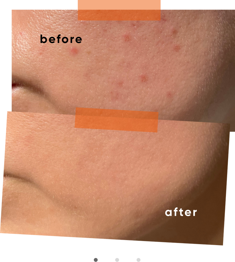 Collagen Results 1